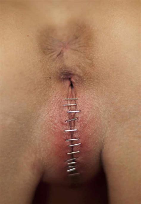 Sixlet reccomend piercing pussy shut needles painful bdsm