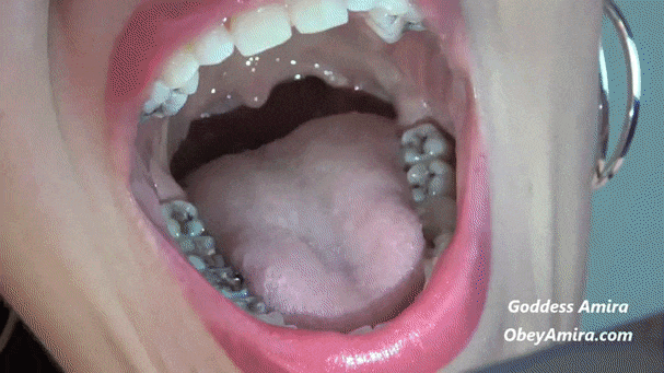 Wind reccomend tongue teeth uvula show short version
