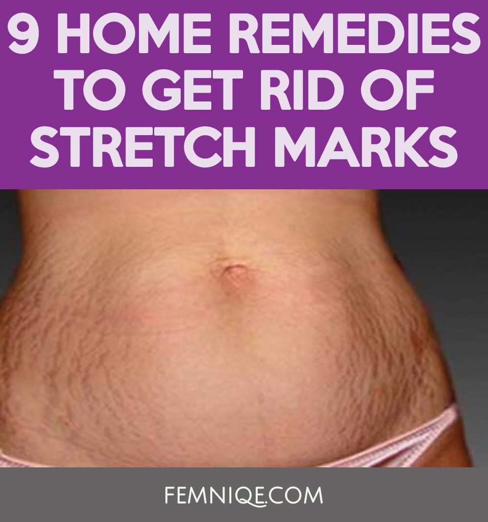 Aftermath know have really stretch marks