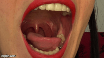 best of Uvula teeth close tongue