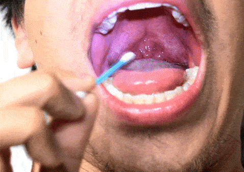 Teeth tongue uvula close