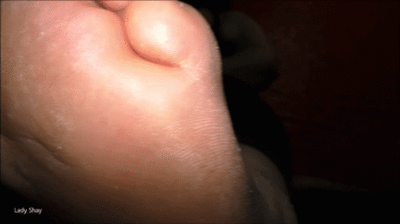 best of Doesnt soles mature know callused