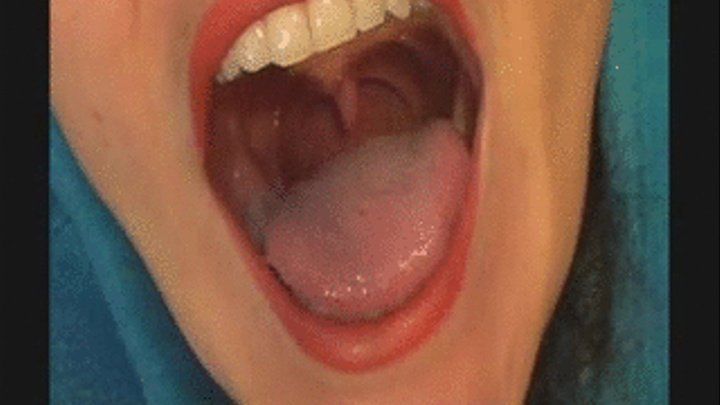 Summers throat uvula reflex