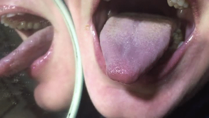 Hard-Boiled reccomend uvula teeth close tongue