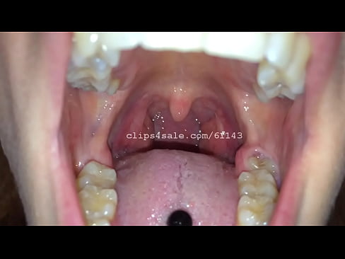 Zelda reccomend tongue teeth uvula show short version
